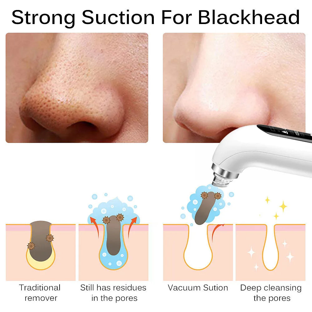 Blackhead Removal Pore Vacuum Face Cleaner Black Head Remover